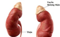 Nhận biết sớm dấu hiệu suy tuyến thượng thận ở trẻ