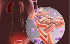 Lao tiết niệu dễ nhầm với bệnh gì, cách phát hiện?