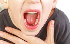 Triệu chứng viêm VA cấp tính và mạn tính ở trẻ em