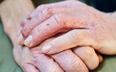 Sản phẩm được nhiều người viêm da cơ địa tin dùng