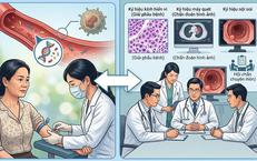Xét nghiệm ctDNA có quyết định việc hóa trị sau mổ ung thư đại tràng?