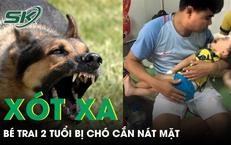 Chơi với đàn chó con, bé trai hơn 2 tuổi bị chó mẹ cắn nát vùng hàm mặt 