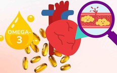 5 sai lầm làm tăng nguy cơ mỡ máu cao