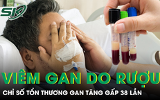 Uống rượu nhiều năm, người đàn ông có chỉ số tổn thương gan tăng gấp 38 lần