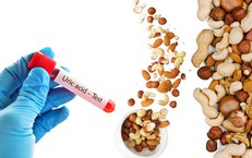 Tăng acid uric máu không chỉ do hải sản mà còn do nhiều thói quen 