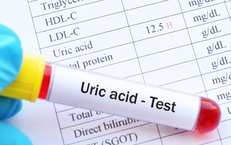 Tăng acid uric có làm suy giảm ‘bản lĩnh’ nam giới?