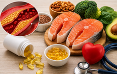 Người bị mỡ máu cao có nên uống omega-3 mỗi ngày?