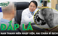 Đắp lá chữa ngứa, nam thanh niên 28 tuổi phải nhập viện với hai chân rỉ dịch