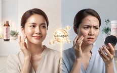 Bổ sung collagen có bị nổi mụn?