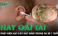 Bé trai liên tục gãi tai, bác sĩ phát hiện hạt cây đã nảy mầm bên trong