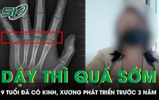 Bé gái 9 tuổi đã có kinh nguyệt, tuổi xương phát triển trước gần 3 năm