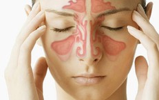5 yếu tố làm tăng nguy cơ viêm xoang
