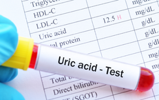 7 lưu ý khi tầm soát acid uric