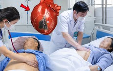 Cứu sống thành công hai vợ chồng bị nhồi máu cơ tim nguy kịch