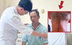Ngã võng sau cuộc nhậu, người đàn ông 43 tuổi gãy đốt sống cổ