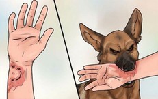 Chó nghi mắc bệnh dại tấn công 6 người ở Quảng Ngãi