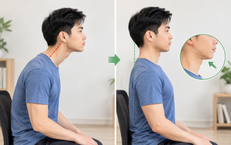 'Cổ rùa' do dùng điện thoại: 4 bài tập giúp cải thiện tư thế