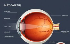 5 thói quen khiến độ cận ngày càng tăng nhanh