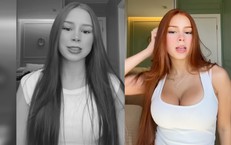 Nữ TikToker 22 tuổi qua đời, video cuối cùng hé lộ ca phẫu thuật vòng 1