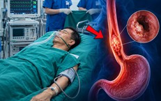 Làm 3 việc này suốt 30 năm, người đàn ông phát hiện mắc ung thư thực quản