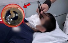 Bạn bật ô che mưa, nam sinh bị vỡ nhãn cầu có thể mù vĩnh viễn