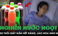 Nghiền nước ngọt, người phụ nữ 35 tuổi mất gần hết răng, lão hóa như 60