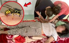 Người phụ nữ hôn mê vì ong vò vẽ đốt 20 nốt khi đi chăn bò