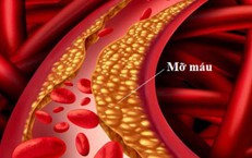 Làm thế nào để biết mình đang bị máu nhiễm mỡ?