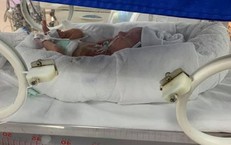 Các yếu tố nguy cơ dẫn đến sinh non mẹ bầu cần lưu ý