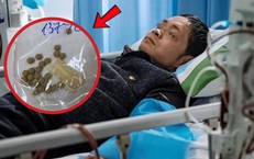 Người đàn ông suy gan vì tự uống thuốc chữa xơ gan, vàng da gấp 42 lần
