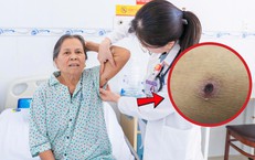 Ve mò đốt, cụ bà nhiễm trùng huyết nguy kịch