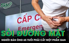 Sỏi đường mật khiến người đàn ông 65 tuổi phải cắt một phần gan