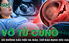Thai phụ 36 tuần vỡ tử cung dù không ra máu, tim thai vẫn bình thường