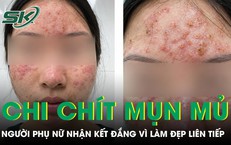 Làm đẹp liên tiếp, người phụ nữ 38 tuổi nhận cái kết đắng