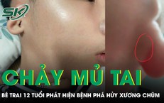 Bé 12 tuổi chảy mủ tai hôi, phát hiện bệnh phá hủy xương chũm