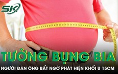 Tưởng bụng bia, người đàn ông 33 tuổi phát hiện khối u 15cm