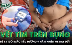 Bé trai 13 tuổi sống chung với tiểu đường 9 năm, chi chít những vết tím 
