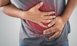 Vitamin D không cải thiện hội chứng ruột kích thích