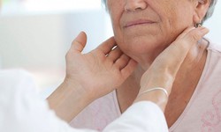 Nhận biết nguy&#234;n nh&#226;n v&#224; điều trị bướu cổ