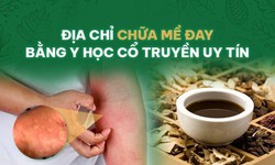 Địa chỉ chữa mề đay bằng Đ&#244;ng y uy t&#237;n, chất lượng