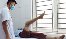 Nếu chẳng may phần chi đứt l&#236;a l&#224;m sao để bảo quản đ&#250;ng trước khi bệnh nh&#226;n đến viện?