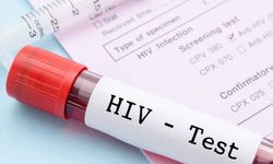 Sau phơi nhiễm với HIV, khi n&#224;o n&#234;n đi x&#233;t nghiệm?