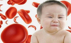 C&#225;ch ph&#242;ng v&#224; điều trị thiếu m&#225;u, thiếu sắt ở trẻ em