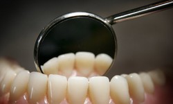 Sử dụng thuốc l&#225; điện tử tăng nguy cơ s&#226;u răng