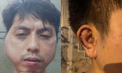 Khởi tố vụ &#225;n nh&#226;n vi&#234;n qu&#225;n lẩu bị đ&#225;nh biến dạng khu&#244;n mặt