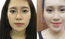 Cắt m&#237; v&#224; c&#225;ch chăm s&#243;c để c&#243; đ&#244;i mắt đẹp