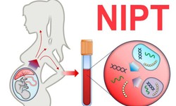 X&#233;t nghiệm NIPT khi mang thai l&#224; g&#236; v&#224; n&#234;n thực hiện ở đ&#226;u?