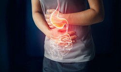 Ứng ph&#243; với vấn đề về bệnh dạ d&#224;y hậu COVID-19