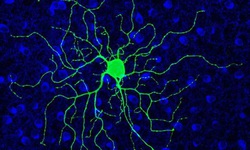 Thuốc cai rượu c&#243; thể gi&#250;p điều trị tho&#225;i h&#243;a v&#245;ng mạc