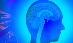 42 gene mới l&#224;m tăng nguy cơ mắc bệnh Alzheimer